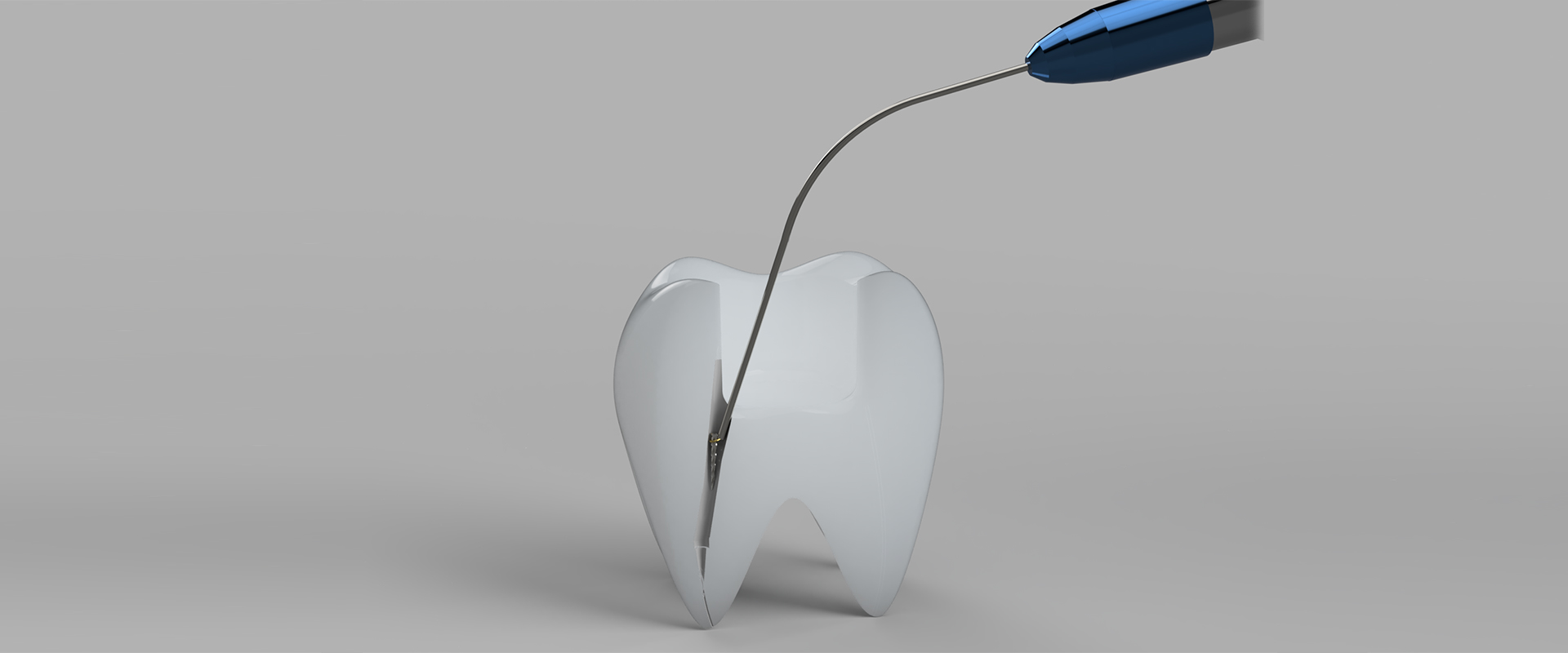 Grau wird wurzelbehandelter zahn Toter Zahn: