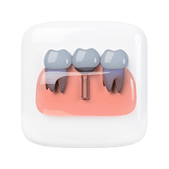 Zahnfleisch & Parodontitis